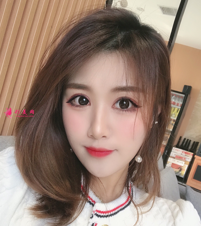 哈醫(yī)大四院美容科李巍隆鼻怎么樣？附隆鼻真人案例及2021價(jià)格表