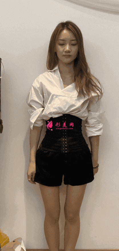 沈陽(yáng)軍區(qū)總醫(yī)院整形科屬于公立醫(yī)院?jiǎn)?？附吸脂案例?021價(jià)格表公開(kāi)