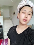 上海九院隆胸怎么樣?多少錢(qián)?有專(zhuān)家案例和價(jià)格表展示！