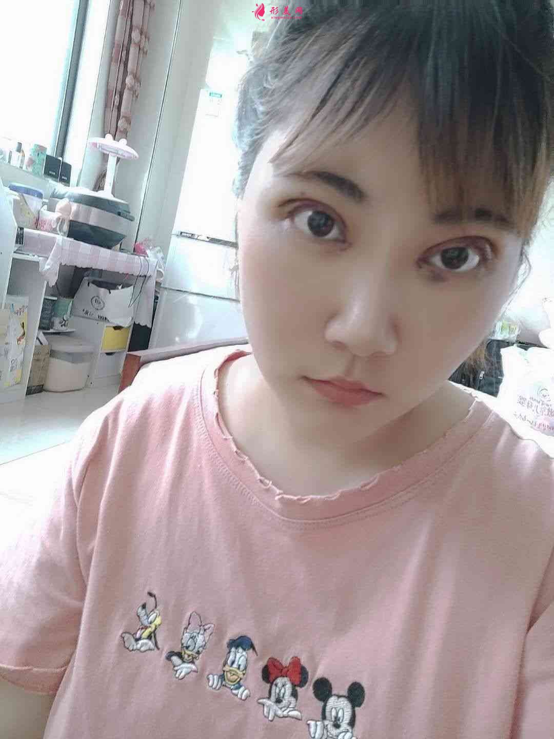 無(wú)錫同濟(jì)醫(yī)療整形美容醫(yī)院怎么樣？附雙眼皮術(shù)后效果對(duì)比及2021價(jià)格表