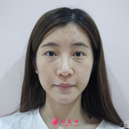 九江整形醫(yī)院那些好？星瑞美、圣嘉麗口碑領(lǐng)銜_除皺案例分享