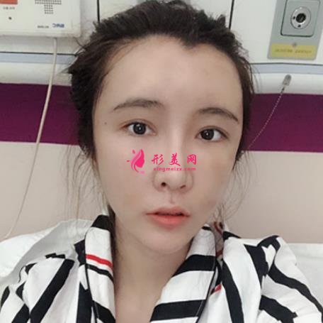 九江整形醫(yī)院那些好？星瑞美、圣嘉麗口碑領(lǐng)銜_除皺案例分享