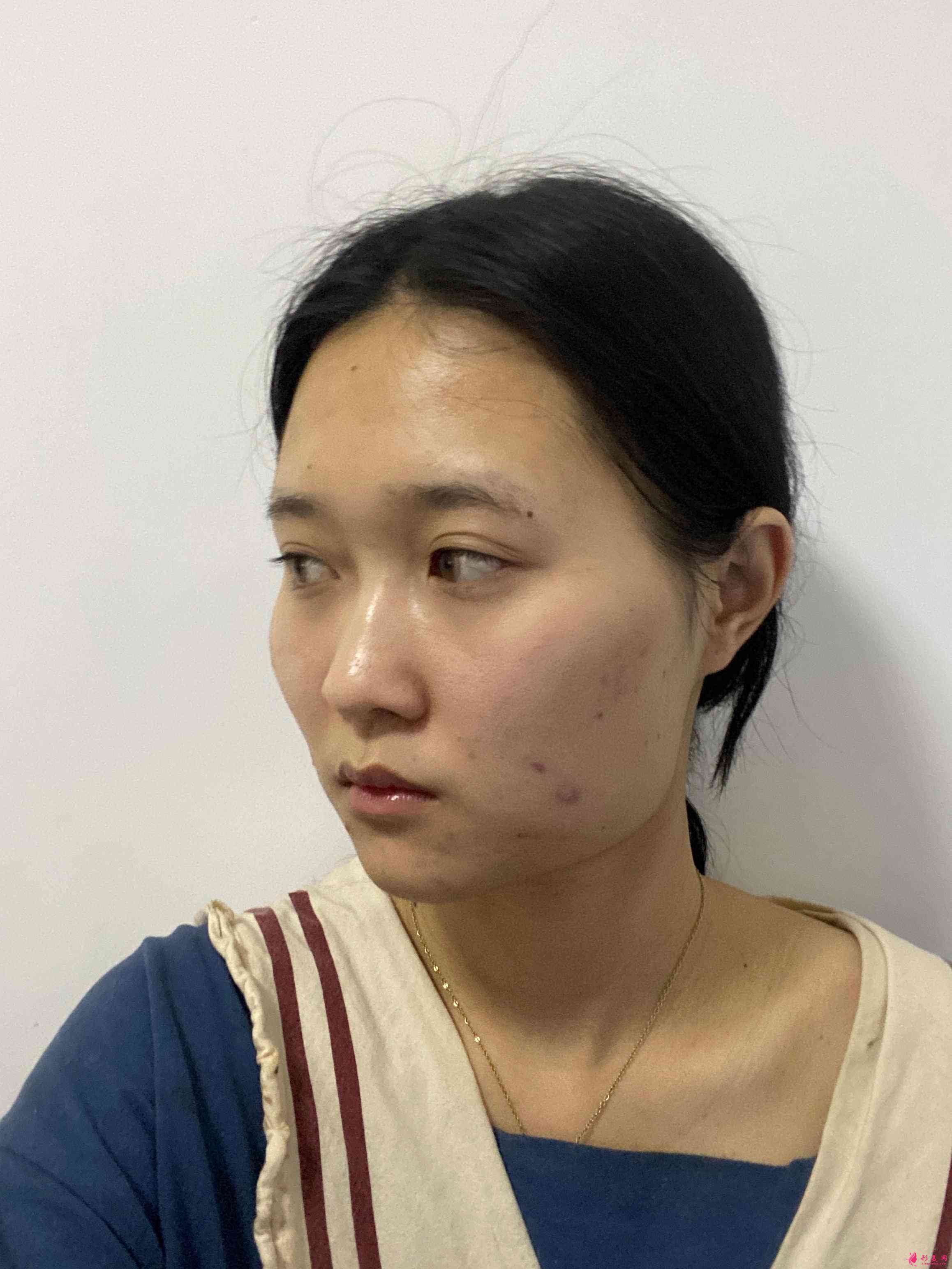 重慶當(dāng)代整形美容醫(yī)院怎樣?2021價(jià)格表發(fā)布+下頜角術(shù)后效果對(duì)比