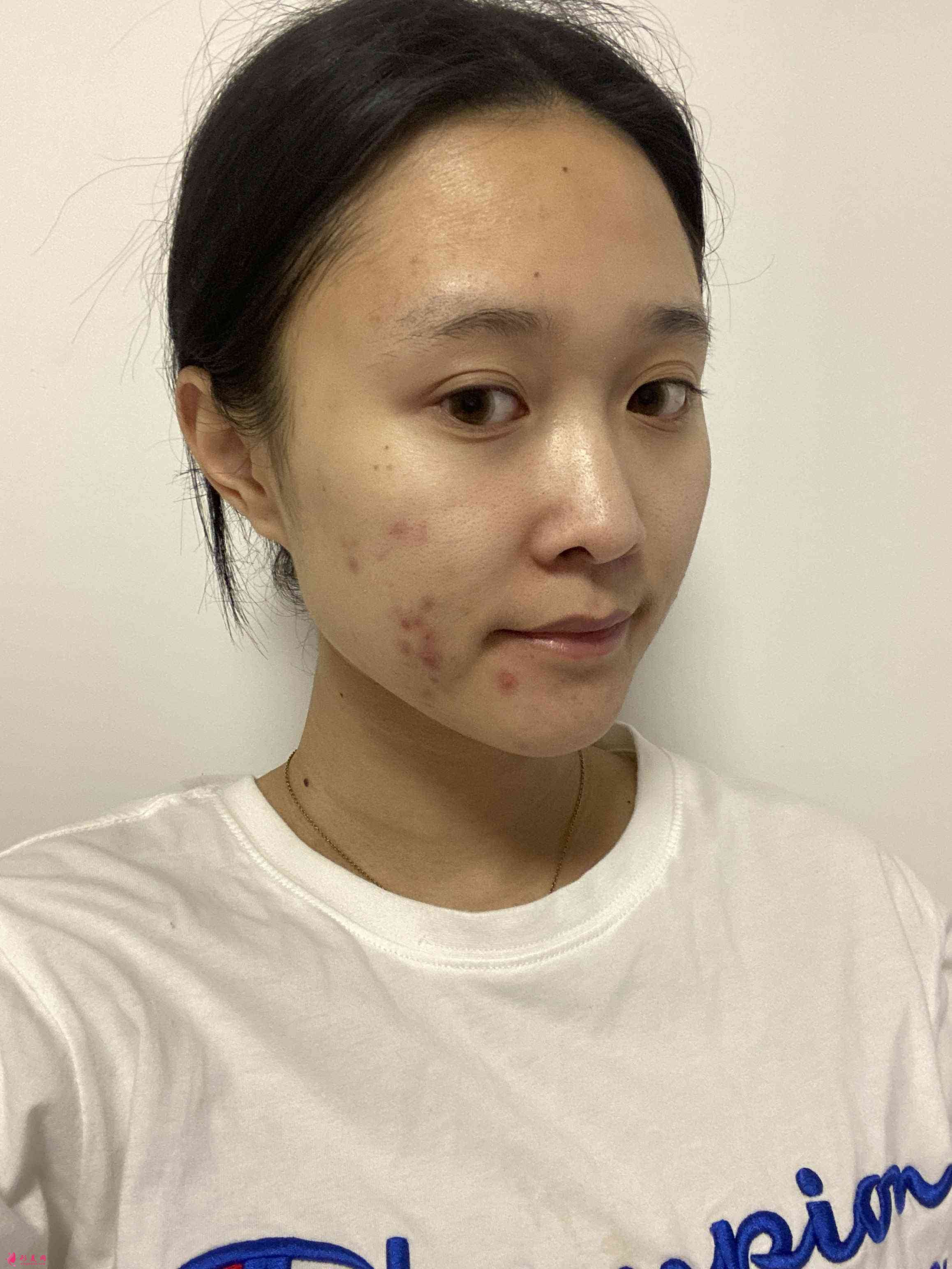 重慶當(dāng)代整形美容醫(yī)院怎樣?2021價(jià)格表發(fā)布+下頜角術(shù)后效果對(duì)比
