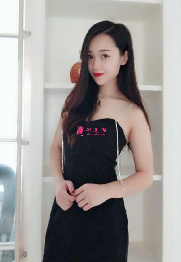 山西省眼科醫(yī)院雙眼皮好不好？小姐姐分享術(shù)后三個(gè)月恢復(fù)效果圖