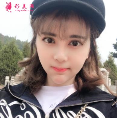 上海長征醫(yī)院整形科面部吸脂怎么樣？術(shù)后瘦臉效果跟美顏相機(jī)說再見！