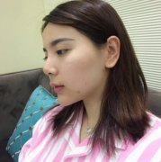 上海長(zhǎng)征醫(yī)院整形科面部吸脂怎么樣？術(shù)后瘦臉效果跟美顏相機(jī)說(shuō)再