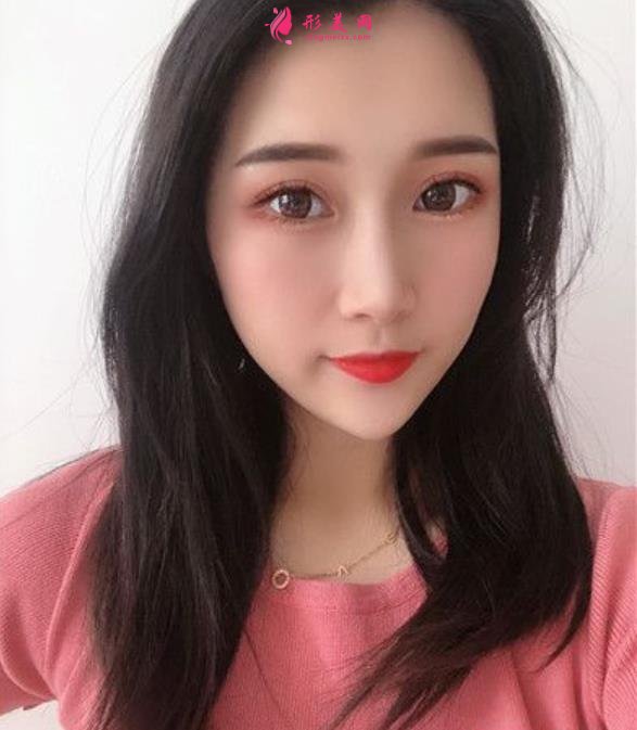 溫州藝星整形美容醫(yī)院做隆鼻怎么樣？好不好？專(zhuān)家案例價(jià)格收費(fèi)一覽