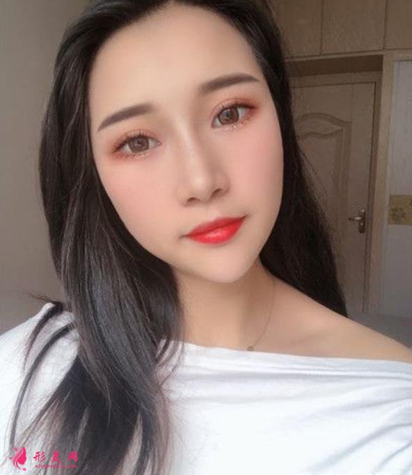 溫州藝星整形美容醫(yī)院做隆鼻怎么樣？好不好？專(zhuān)家案例價(jià)格收費(fèi)一覽