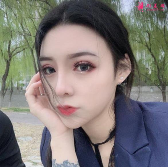 南京友誼醫(yī)院整形科隆鼻案例術(shù)后恢復(fù)過程分享！含全新醫(yī)美價格表