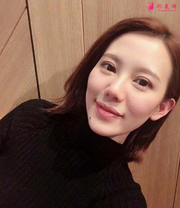泰安中心醫(yī)院眼綜合案例介紹，過來人手術記錄全過程