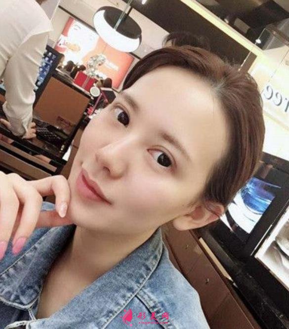 泰安中心醫(yī)院眼綜合案例介紹，過來人手術記錄全過程
