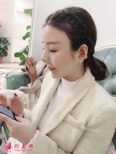 南京康美馮思陽隆鼻怎么樣？看完下面真實(shí)案例及價(jià)格收費(fèi)表再來評(píng)價(jià)