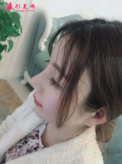 南京康美馮思陽隆鼻怎么樣？看完下面真實(shí)案例及價(jià)格收費(fèi)表再來評(píng)價(jià)