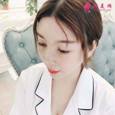 南京康美馮思陽隆鼻怎么樣？看完下面真實(shí)案例及價(jià)格收費(fèi)表再來評(píng)價(jià)