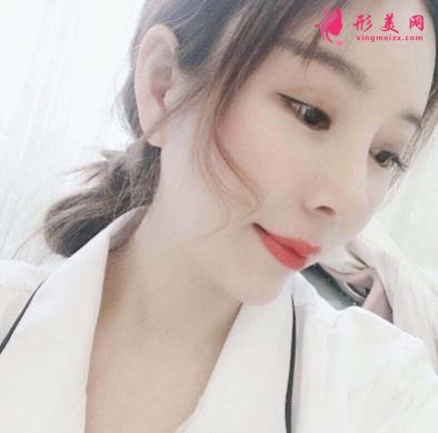 南京康美馮思陽隆鼻怎么樣？看完下面真實(shí)案例及價(jià)格收費(fèi)表再來評(píng)價(jià)