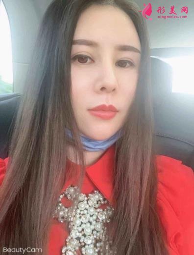 南京鼻祖整形醫(yī)院怎么樣？案例前后變化圖及隆鼻價(jià)格價(jià)目表分享