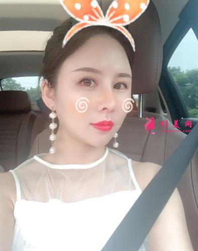 南京鼻祖整形醫(yī)院怎么樣？案例前后變化圖及隆鼻價(jià)格價(jià)目表分享