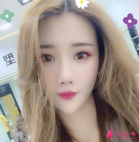 上海有名氣隆鼻醫(yī)生牛永敢做鼻子多少錢?價格收費(fèi)標(biāo)準(zhǔn)及真實案例反饋