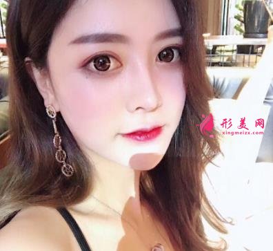 鄭大一附院整形科做鼻子怎么樣？醫(yī)生案例及價(jià)格價(jià)目表公開反饋