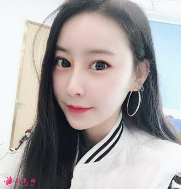 康華醫(yī)院鼻綜合多少錢？花五萬做隆鼻！整形醫(yī)生笑哭了