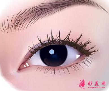 徐州醫(yī)院雙眼皮做得好嗎？案例效果分享_眼部修復(fù)干貨盤點(diǎn)