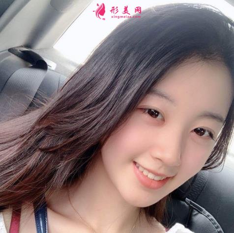 哈醫(yī)大一院美容科雙眼皮怎么樣？恢復(fù)效果分享_手術(shù)后如何護(hù)理?