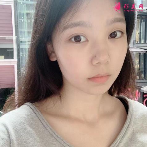 上海九院下頜角磨骨怎么樣？特色技術(shù)分析和案例效果圖匯總！你評評效果如何