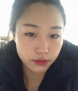 淮安市第一人民醫(yī)院整形科怎么樣?瘦臉針案例+價(jià)格價(jià)目表分享