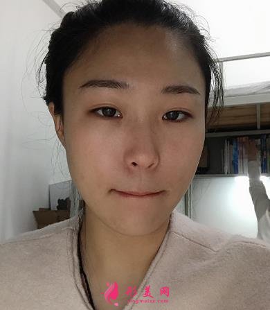淮安市第一人民醫(yī)院整形科怎么樣?瘦臉針案例+價格價目表分享