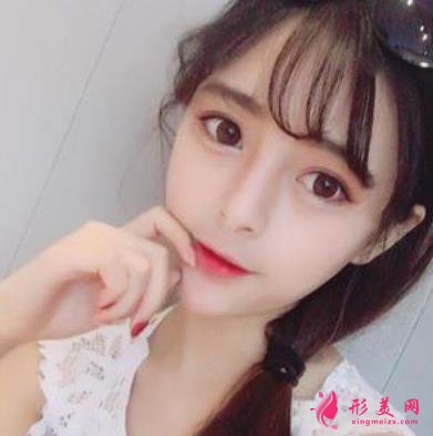臺州恩澤醫(yī)院整形科隆鼻怎么樣？2021價格價目表+案例恢復(fù)日記分享