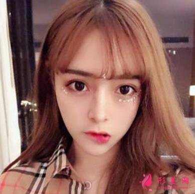臺州恩澤醫(yī)院整形科隆鼻怎么樣？2021價格價目表+案例恢復(fù)日記分享