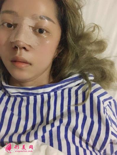 金華永康光大醫(yī)療美容隆鼻怎么樣？案例效果圖和價格價目表同步分享