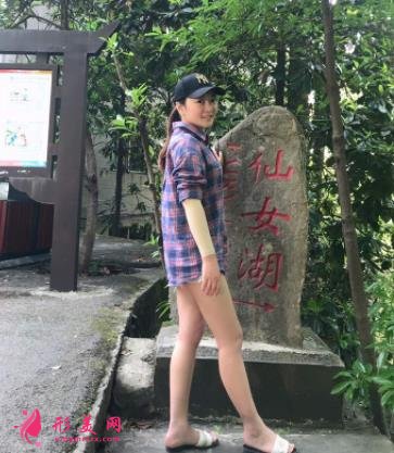 溫州醫(yī)科大學(xué)附屬第二醫(yī)院整形科吸脂怎么樣？?jī)r(jià)格及案例分享