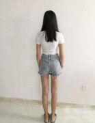 第四軍醫(yī)大學(xué)西京醫(yī)院整形科吸脂效果咋樣？案例價(jià)格收費(fèi)表一覽