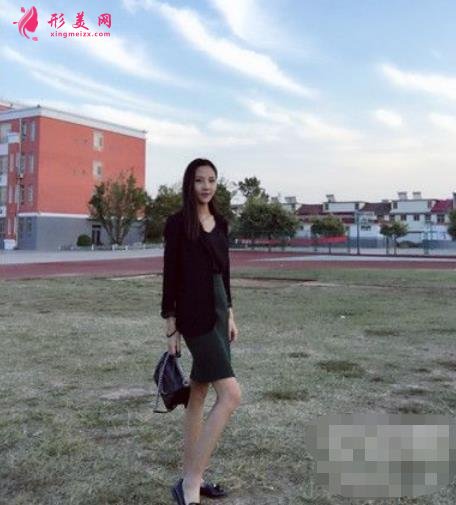 第四軍醫(yī)大學西京醫(yī)院整形科吸脂效果咋樣？案例價格收費表一覽