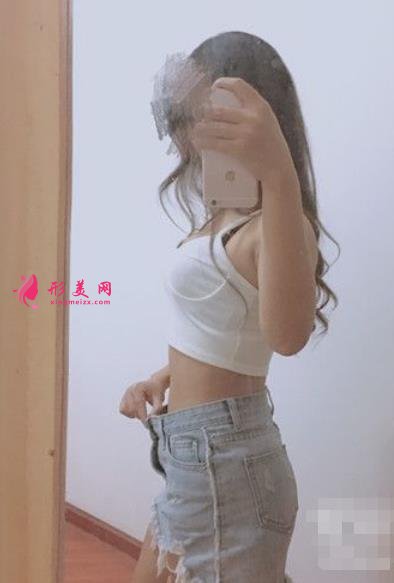 華西醫(yī)院整形科吸脂案例術(shù)后反饋！價格收費標準全新出爐~