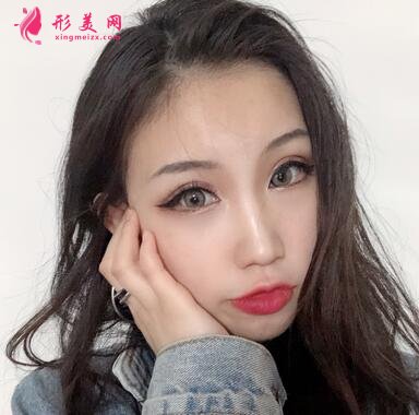 上海九院整形科價格(價目)表全新出爐!隆鼻案例反饋~