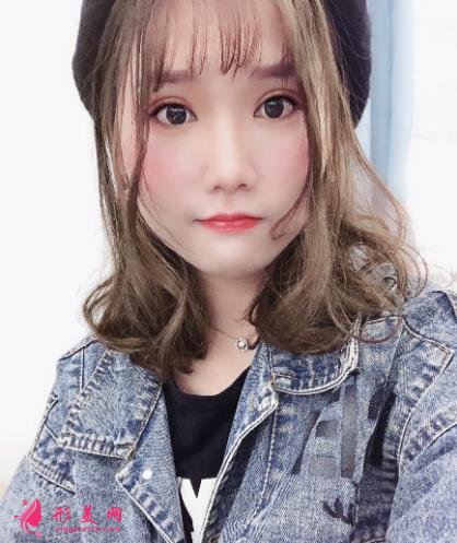 中日友好醫(yī)院整形科雙眼皮怎么樣？開眼角留疤了怎么辦？