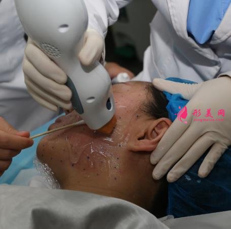 上海九院整形科熱瑪吉抗衰效果怎么樣？看案例即可見(jiàn)證！附價(jià)格表