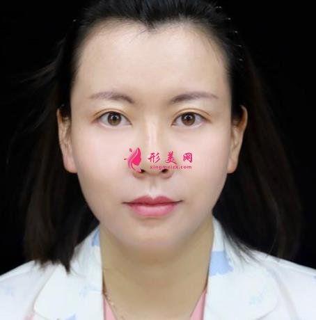 浙醫(yī)二院整形科做熱瑪吉怎么樣？專家案例、價格表清單一一盡顯！