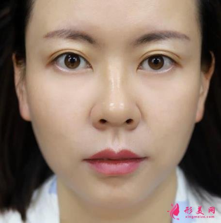 浙醫(yī)二院整形科做熱瑪吉怎么樣？專家案例、價格表清單一一盡顯！