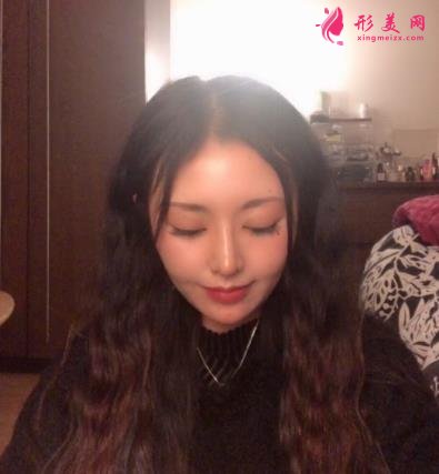成都新麗美整形醫(yī)院隆鼻怎么樣？口碑案例和正規(guī)費(fèi)用（價(jià)格表）一覽