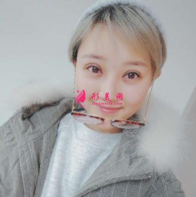 成都潤(rùn)美玉之光整形怎么樣？自體脂肪全臉填充案例和真實(shí)價(jià)格價(jià)目分享
