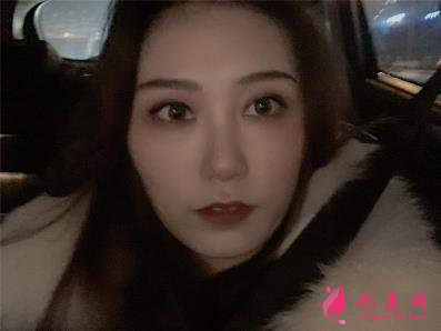 鄭東美眼醫(yī)療美容怎么樣？雙眼皮案例效果反饋圖及價(jià)格費(fèi)用清單查詢