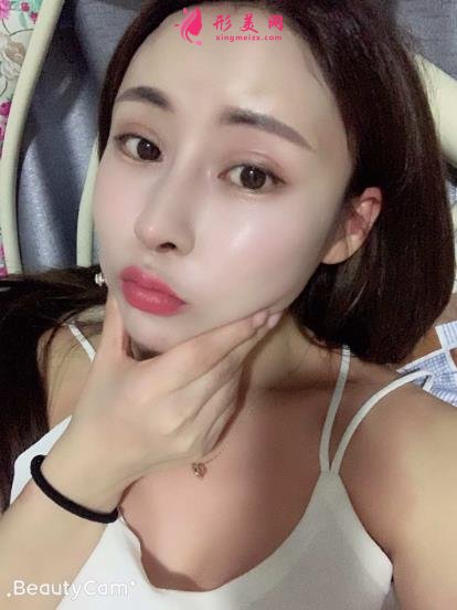 上海伯思立沈國雄鼻修復(fù)怎么樣？專家案例和價(jià)格表參考如下！