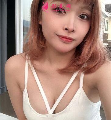 武漢協(xié)和整形科自體脂肪隆胸案例反饋如下！還有整形價(jià)格收費(fèi)表參考