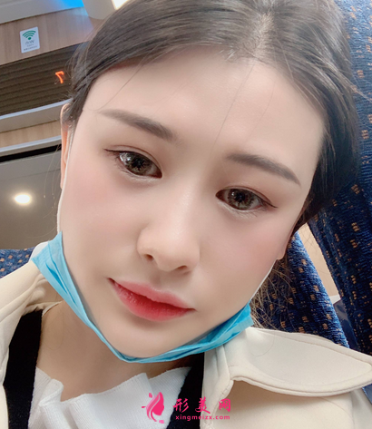 佛山禪城中心醫(yī)院整形磨骨咋樣？案例效果反饋_整形價(jià)格同步一覽