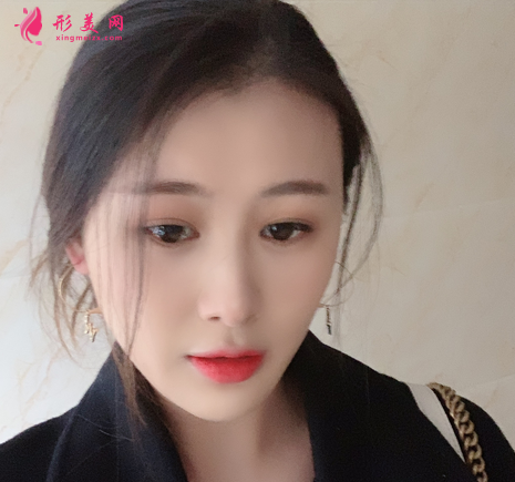 佛山禪城中心醫(yī)院整形磨骨咋樣？案例效果反饋_整形價(jià)格同步一覽