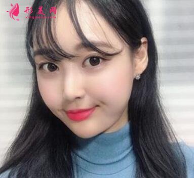 北京八大處整形醫(yī)院熱瑪吉怎么樣？案例_價(jià)格表收費(fèi)標(biāo)準(zhǔn)一覽